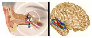 What is Tinnitus?
